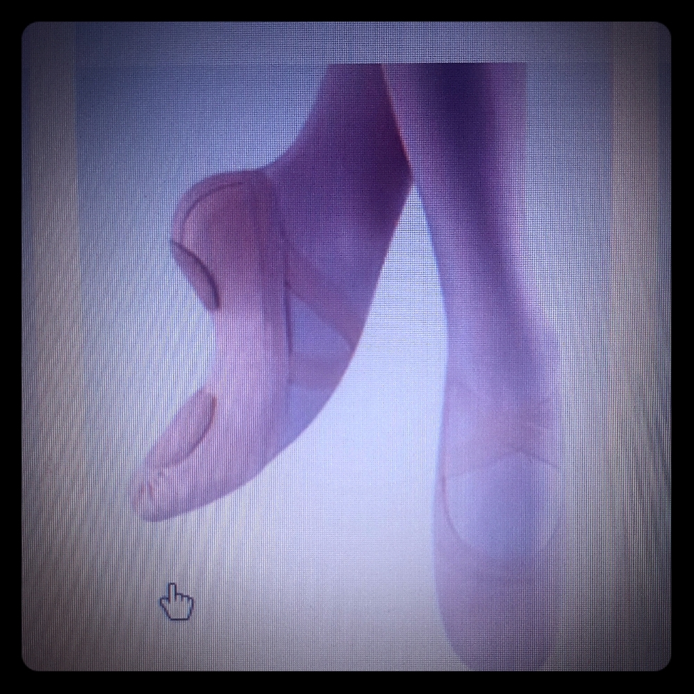 Pink canvas ballet shoes